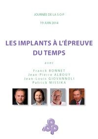 Les implants à l'épreuve du temps