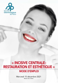 Incisive centrale : restauration et esthétique